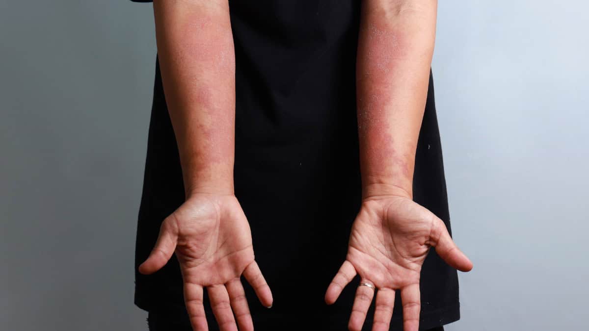 humane detentieomstandigheden richtlijnen